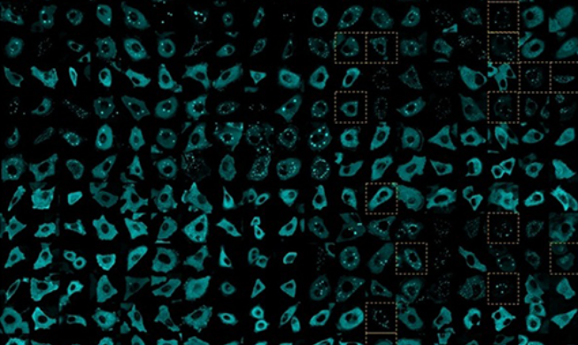 Tim Peneliti Korea-AS Ungkap Rahasia Jalur Perpindahan Sel Kanker